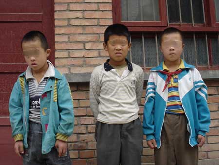 小学校称智障学生没法教 让其跳级早日毕业