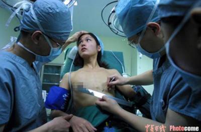 漂亮女孩隆胸全过程