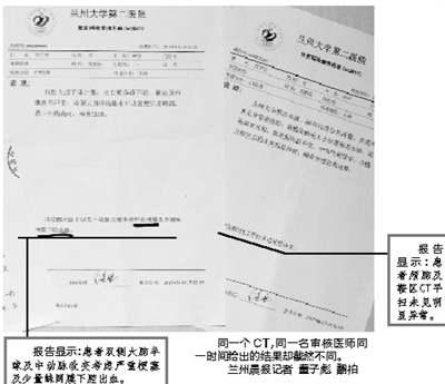 兰大二院同一时间同一医生两份迥异的ct报告引出一场医患官司
