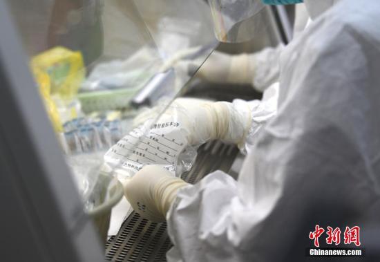 2月10日,位于贵阳的贵州省人民医院检验科进行核酸检测。开展核酸检测,是目前及时有效发现和控制新冠肺炎传染源的重要手段,核酸检测可以有效做到早发现,早隔离。截至目前,贵州开展核酸检测完成采样37477人、检测24887人。 <a target='_blank' data-cke-saved-href='http://www.chinanews.com/' href='http://www.chinanews.com/'>中新社</a>发 武敏 摄 2月10日,位于贵阳的贵州省人民医院检验科进行核酸检测。开展核酸检测,是目前及时有效发现和控制新冠肺炎传染源的重要手段,核酸检测可以有效做到早发现,早隔离。截至目前,贵州开展核酸检测完成采样37477人、检测24887人。 <a target='_blank' data-cke-saved-href='http://www.chinanews.com/' href='http://www.chinanews.com/'>中新社</a>发 武敏 摄