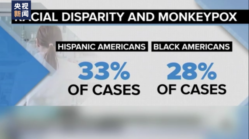 美国猴痘疫情蔓延 拉美裔和非洲裔受影响较大