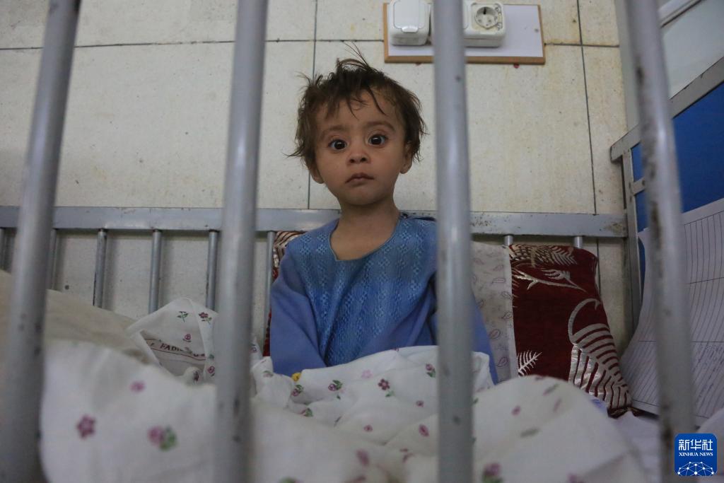 通讯：美国制裁使阿富汗营养不良患儿激增