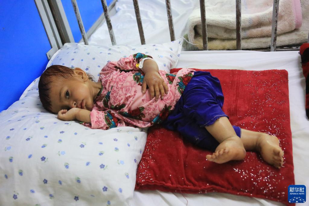 通讯：美国制裁使阿富汗营养不良患儿激增