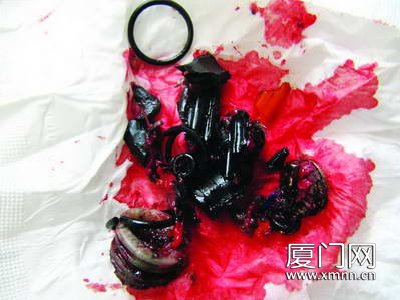 厦门一压力升降旋转椅爆炸零件贯穿<em>女子身体</em>_