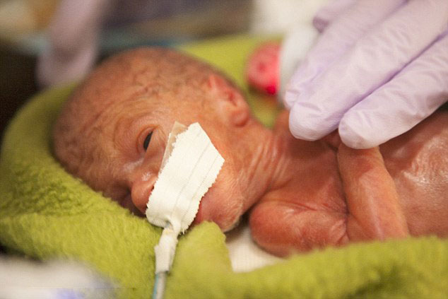 36周胎儿出生的图片图片